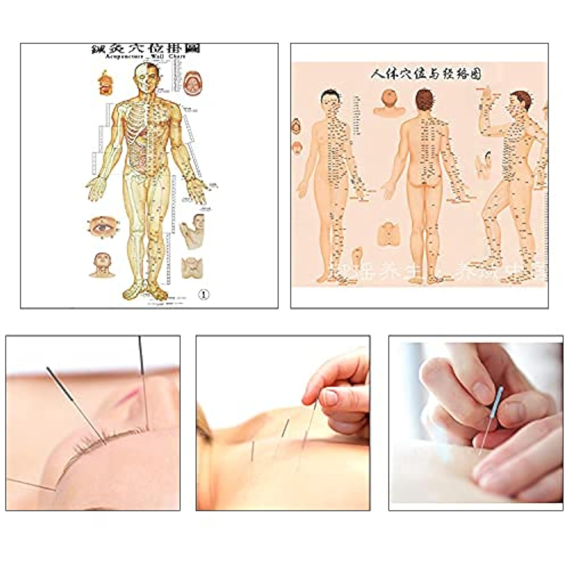 Manual Acupuncture Needles, Pack of 100
