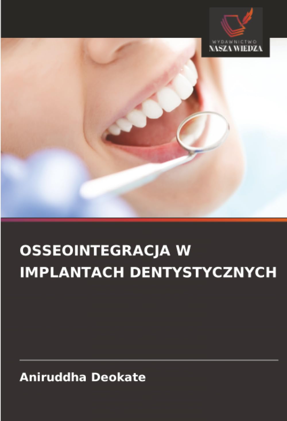 OSSEOINTEGRACJA W IMPLANTACH DENTYSTYCZNYCH