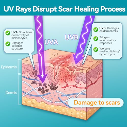 Image of Dimora UPF50+ Silicone Scar Sheets with UV Protection Reusable Sheets to Soften, Flatten Fade Scars, Reduce Redness for Surgical, C-Section, Burn, Keloid, and Hypertrophic Scars (1.6 inchx78.7 inch Roll)