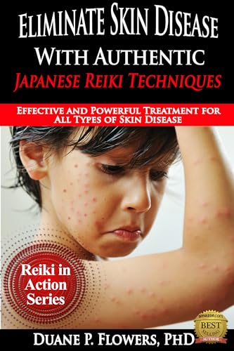 Eliminate Skin Disease with Authentic Japanese Reiki Techniques: Effective and Powerful Treatment for All Types of Skin Disease