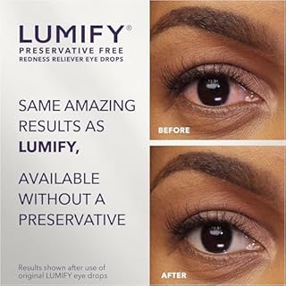 LUMIFY Preservative Free Eye Drops for Red Eyes, Redness Reliever for Sensitive Eye, Brighter and Whiter Looking Eyes, Works in 1 Minute & Lasts Up to 8 Hours, 20 Single-Use Vials