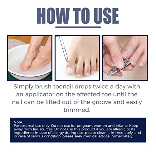 Nail Inlaying Essence, 2/3/5 Pcs Toenail Care Oil For Removing Paronychia, Nail Care Oil, Nail Care For Healthy Foot And Hand (5Pcs) #TOP6