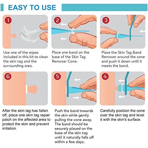 116 Stck Skin Tag Removal Patch Kit, Stielwarzen Entfernen schnell Entfernen Schnell Kit fr Gesicht, Hals und Krper - Image 5