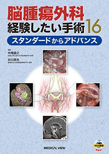 脳腫瘍外科 経験したい手術16−スタンダードからアドバンス