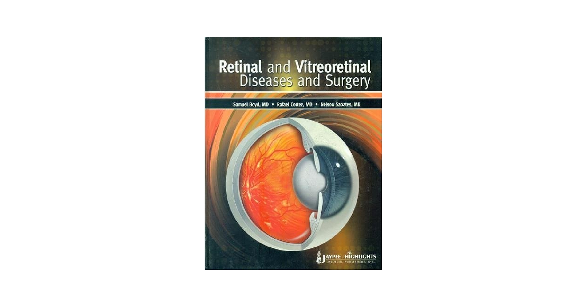 Retinal and Vitreoretinal Surgery: Mastering the Latest Techniques Boyd， Benjamin F. 51FgqGerFRL._UF1000,1000_QL80_.jpg
