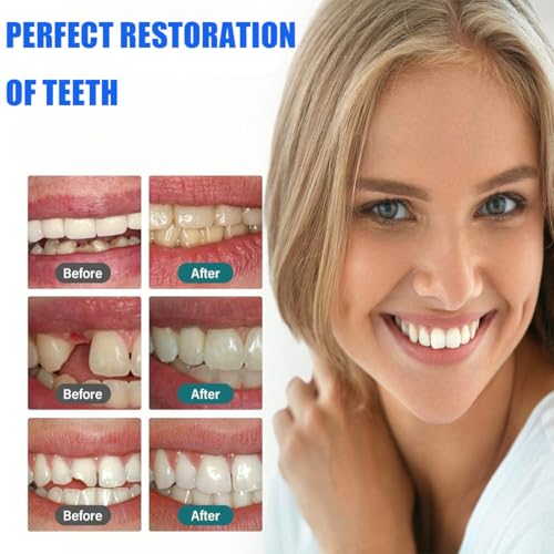 Image of Temporary Replacement Tooth Repair Kit, Zinc Oxide Eugenol Cement Dental Care Kit Glue for Crowns & Bridges Filling, Perfect Smile (4)