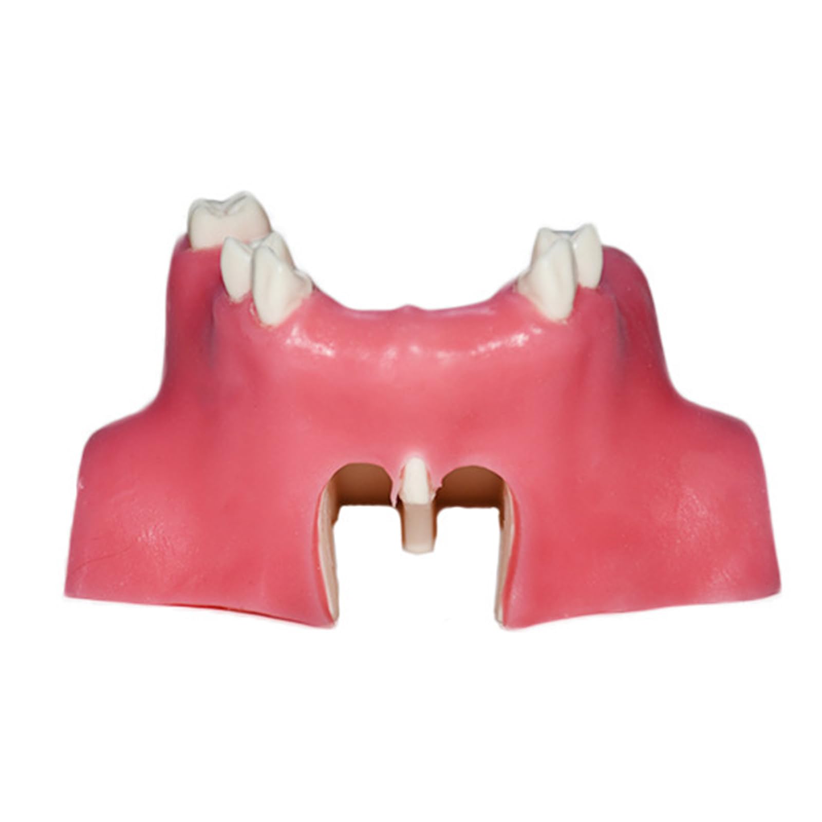 Modello di impianto Dentale - Modello di impianto mandibolare Medico e odontoiatrico - per Studio didattico Displaymedical Model，A9 8cm