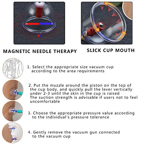 Set di Coppettazione, Coppetta Magnetica
