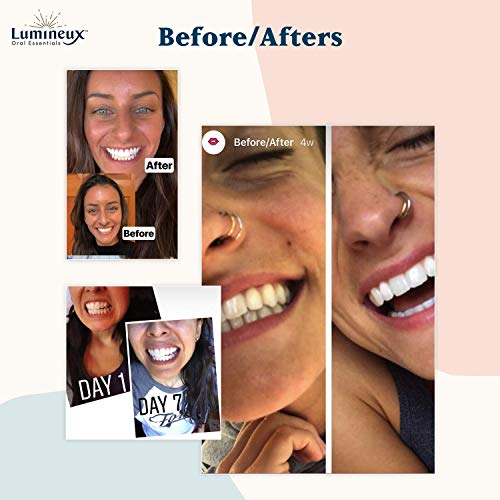 Lumineux Teeth Whitening Kit - Image 7