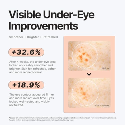 Image of Enaskin Naturals Under Eye Patches for Dark Circles: 30 Pairs PDRN & Peptide Eye Gels Mask - Reduce Wrinkles Puffy & Bags - Skin Treatment Pads - Anti Aging Moisturizer For Women (Salmon Pink)