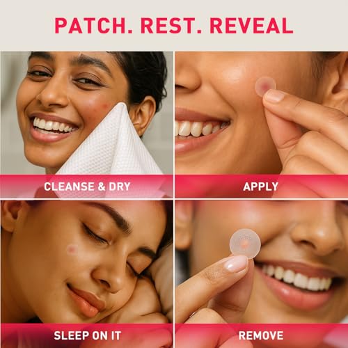 Image of Sirona Anti Acne Pimple Patches for Face - 36 Dots (Pack of 2) | Invisible Facial Stickers Cover with Hydrocolloid Waterproof Patches