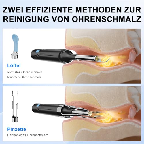 6 in 1 Kamerawerkzeug zur Ohrenschmalzentfernung mit Pinzette, Ear Scope Otoskop Set mit 6 LED Kameralichtern, visueller Ohrpicker, kabelloser Ohrenschmalzentferner (schwarz, DF004)