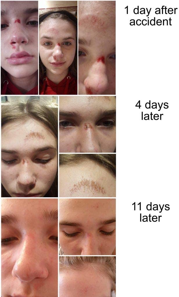 Serum Tc16 Di Arkada Serum Che Ricostruisce La Pelle Problematica E Le Unghie Danneggiate, Trattamento Intenso Al Collagene - 11 Ml