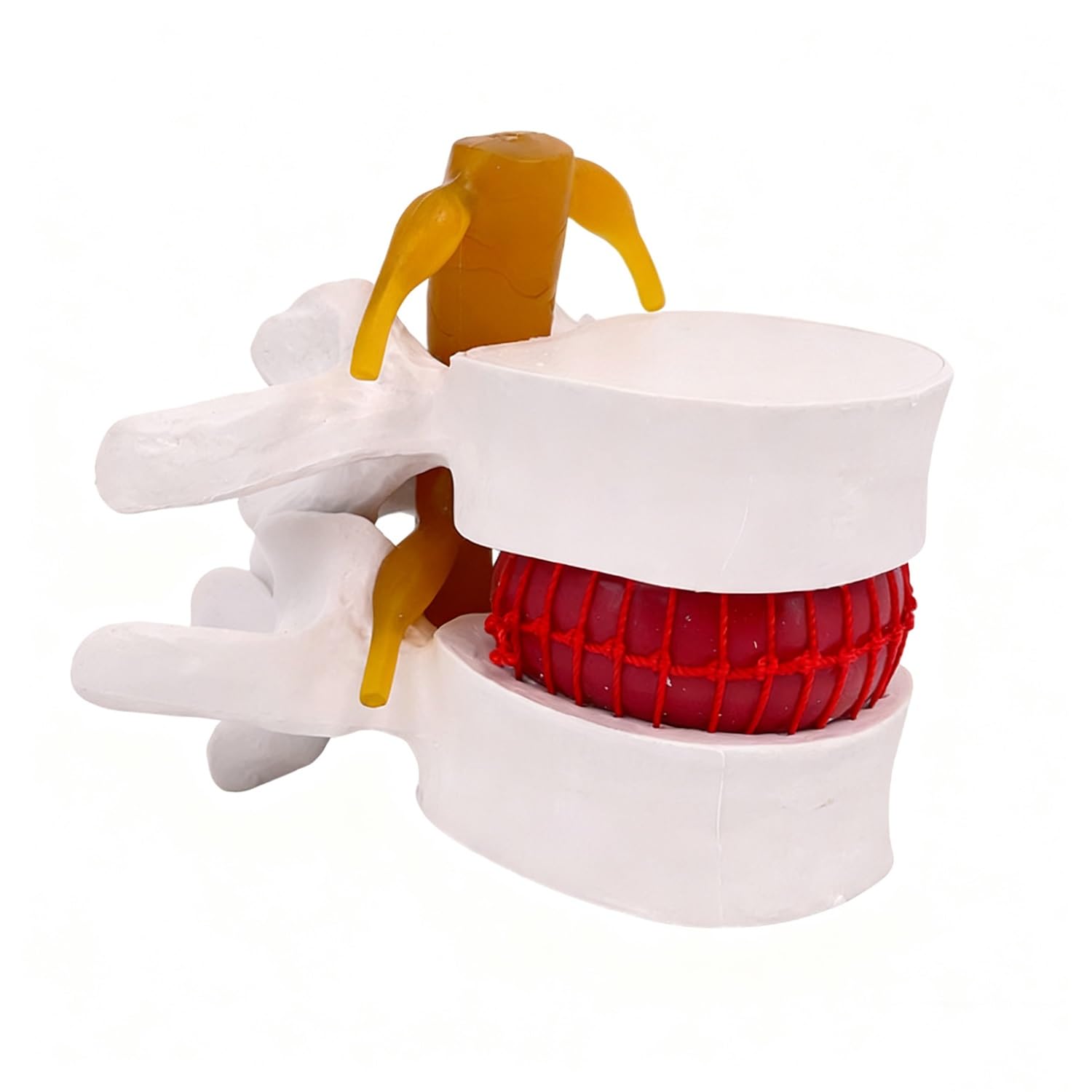 YXHXWKJ Human Anatomical Lumbar Disc Herniation Model-1.5 Times Life Size Lumbar Disc Teaching Model Tool For Medical &Teaching & Learning And Scientific Presentations(White)