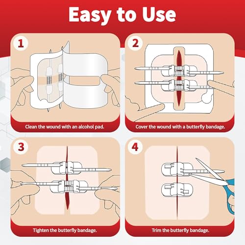 RYNORA 52 Pack Wound Closure Strips Sets, 3 Types Butterfly Bandages, Repair Wounds Without Stitches, Quick Clot Zip Stitch Wound Closures Device with 4 Wound Dressings and 4 Waterproof Dressings