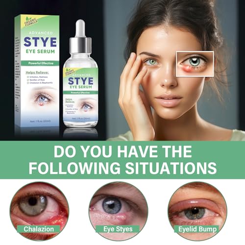 Stye Eye Treatment, Effective Stye Eye Drops Serum for Styes Chalazion and Blepharitis, Fast Chalazion Remover for Restore Healthier Eye Skin