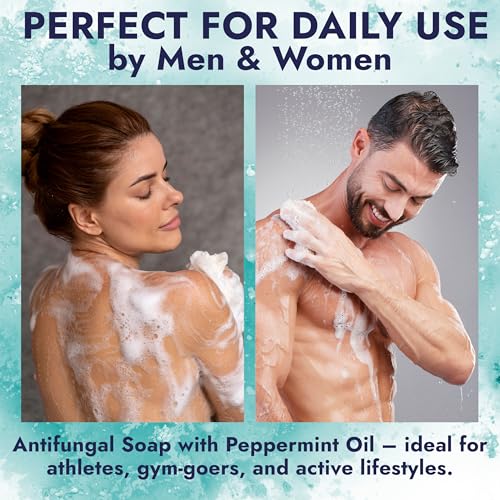 Image of Antifungal Soap Infused with Peppermint Essential Oil for Itchy Skin