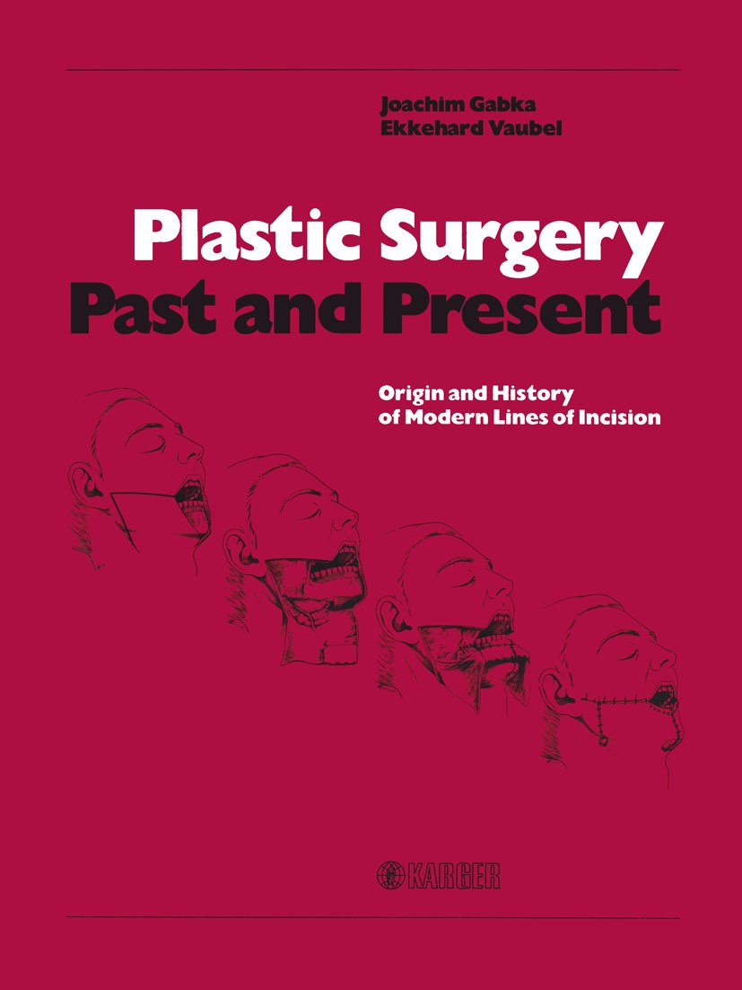Plastic Surgery - Past and Present: Origin and History of Modern Lines of Incision      [Print Replica] Kindle Edition