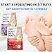 5 Pack Foot Peel Mask,Exfoliator Peel Off Calluses Dead Skin Callus Remover,Foot Mask for Dry Cracked Feet,Smooth Touch Feet Peel Mask with Lavender & Rose Gel for Men Women Feet Peeling Mask