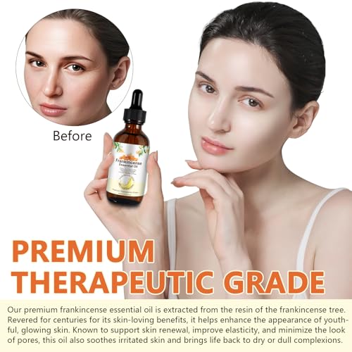 Frankincense Oil, 60ml Ätherisches Weihrauchöl für Gesicht und Körper, Reduziert feine Linien, Dehnungsstreifen, spendet Feuchtigkeit und beruhigt Haut, Duftöle für Aromatherapie, Hautpflege, Massage