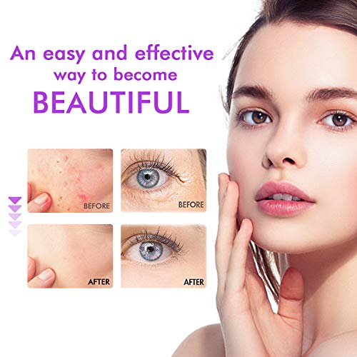 Risiya High Frequency Facial Machine, Portable Handheld Skin Therapy Wand - Skin Tightening - Wrinkle Reducing - Dark Circles - Puffy Eyes Beauty Skin Care Tool