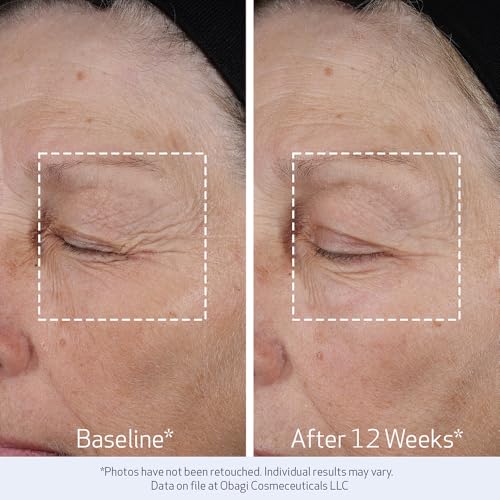 Obagi Medical Obagi ELASTIderm Lift Up & Sculpt Facial Moisturizer – Clinically Proven Anti-Aging Face Cream that Visibly Firms & Sculpts Facial Contours, & Reduces Fine Lines & Wrinkles with Peptides – 1.7 oz