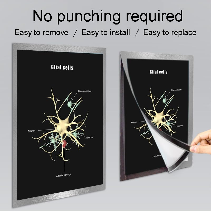 Image of Taanfu Body Educational Learning Anatomy Posters ，Glial cells Art cells Villi Anatomy Art Poster Digestive System Organs Illustration Small Intestine Physiology Anatomy Wall Art Villi