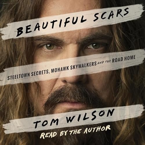 Page de couverture de Beautiful Scars