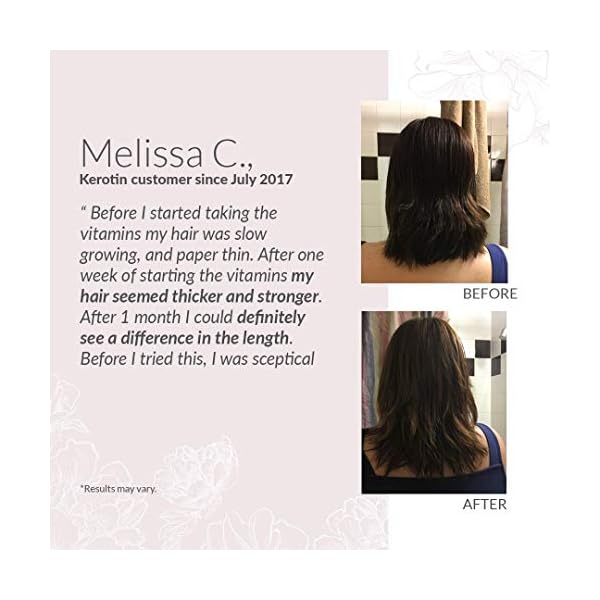 Kerotin Hair Growth Vitamins, Biotin Supplement, DHT Blocker, Collagen Stimulator, for Hair Loss Support, Nail & Skin Care, Includes Saw Palmetto, Vitamin D3 & More - 60 Pills (1 Month Supply)