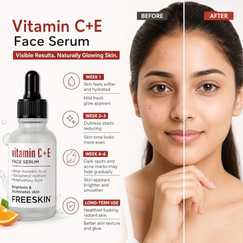 Image of Freeskin Vitamin C + E Face Serum with Ethyl Ascorbic Acid, Tocopheryl Acetate & Polyhydroxy Acid | Brightens & Illuminates Skin | Lightweight & Non-Sticky Formula | For All Skin Types | 30ml