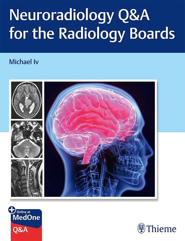 Neuroradiology Q&A for the Radiology Boards (English Edition)