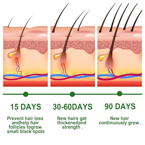 Rosemary Oil for Hair Growth, Pure Natural Rosemary Hair Growth Essential Oil, Wild Growth Hair Oil Serum for Eyelashs, Eyebrows, Improve Hair Loss, Strengthens Hair for Men Women(30ml) - Image 8