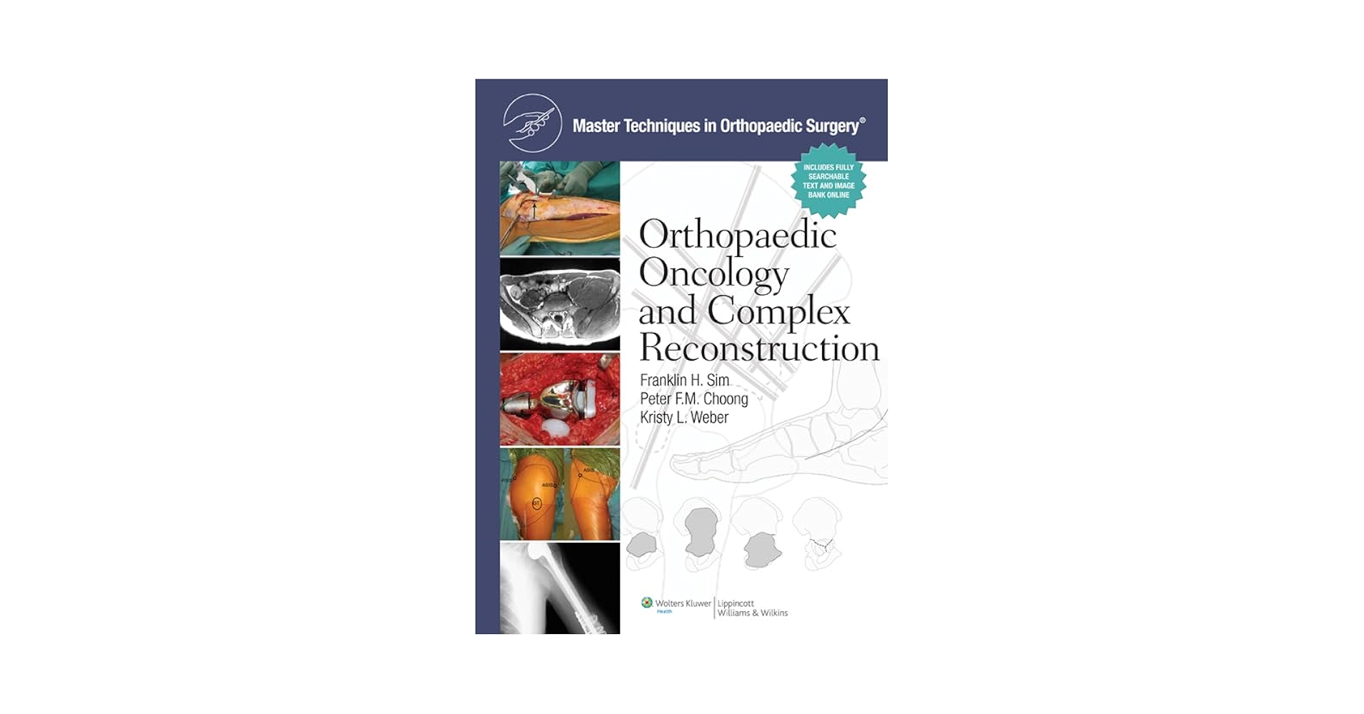 Master Techniques in Orthopaedic Surgery: Orthopaedic