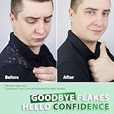 Folliculitis Scalp Psoriasis Treatment Shampoo: Seborrheic Dermatitis, Dandruff & Itchy Scalp Relief with Salicylic Acid, Piroctone Olamine, Rosemary & Coconut Oil - Image 6