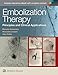 Embolization Therapy: Principles and Clinical Applications