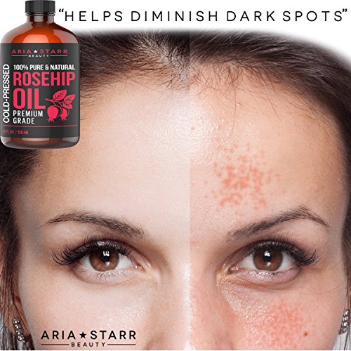 Amazon Com Aria Starr Rosehip Seed Oil Cold Pressed For Face Skin Acne Scars 100 Pure Natural Moisturizer 4 Oz Beauty