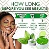 Premium Green Tea Matcha Under-Eye Patches for Puffy Eyes and Eye Bags - Anti-Wrinkle Under-Eye Mask for Dark Circles and Puffiness with Hydrating Effect - Hyaluronic Acid and Collagen Eye Pads