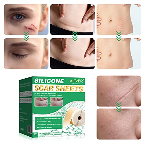 silikonpflaster für narben, professionell für Narben durch C-Sektion, Operationen, Verbrennungen, Keloid, Akne und mehr… - Image 6