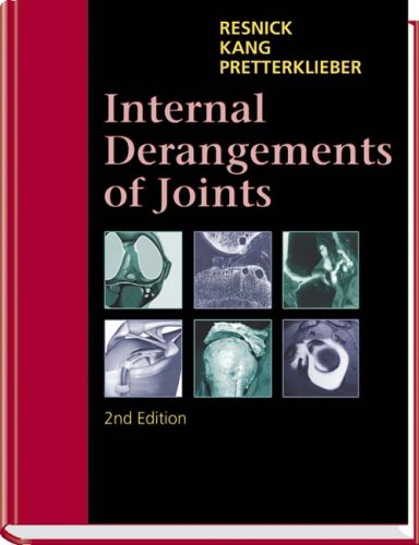 Internal Derangements of Joints: 2-Volume Set, 2e