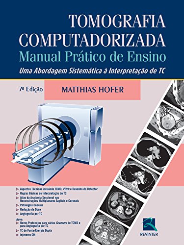 Tomografia Computadorizada: Manual Prático de Ensino - Uma Abordagem Sistemática à Interpretação de TC