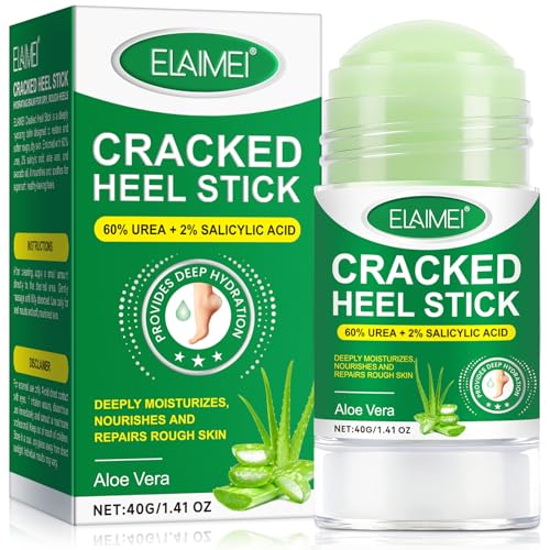 Foot Cream for Cracked Heels and Dry Skin - With 60% Urea & Avocado Oil | Deeply Moisturizes & Nourishes & Repairs Rough Skin | Aloe Vera Feet Cream Rapid Revive Overnight (1 pack, Aloe Vera)