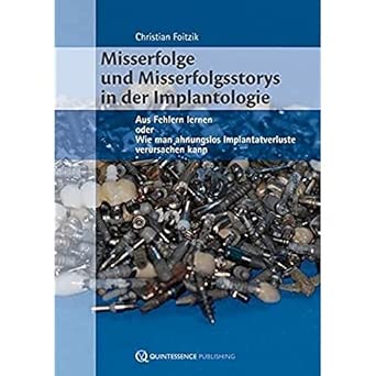 Foitzik, C: Misserfolge und Misserfolgsstorys in der Implant 1., Auflage Edition book cover