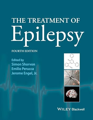 The Treatment of Epilepsy