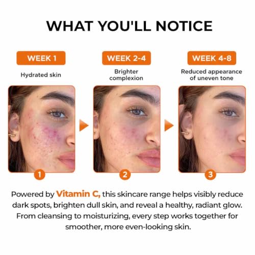 Image of Aqueria 200ml De-Tan & Brightening Vitamin C Face Wash | With Lactic Acid & Niacinamide | Deep Cleansing Face Cleanser for Tan Removal, Pigmentation, Dark Spots, Dull & Uneven Skin Tone | Brightens Skin & Gently Exfoliates | Non-Drying Formula for All Skin Types | 3 Month Pack | Men & Women Gentle Cleanser