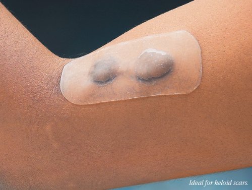 TopiGel Sheet 5 5/8 in x 4 5/8 in (Pack of 1)