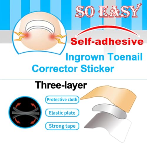 Image of druenza Ingrown Nail Corrector Set, Ingrown Toe Nail Remover & Toenail Correction Tool 20 Strips with Gentle Adhesive 36 Breathable Patches for Daily Nail Care & Home Foot Care Solution