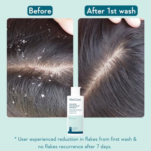 WishCare Hydrating Anti Dandruff Shampoo 120ml - Image 5