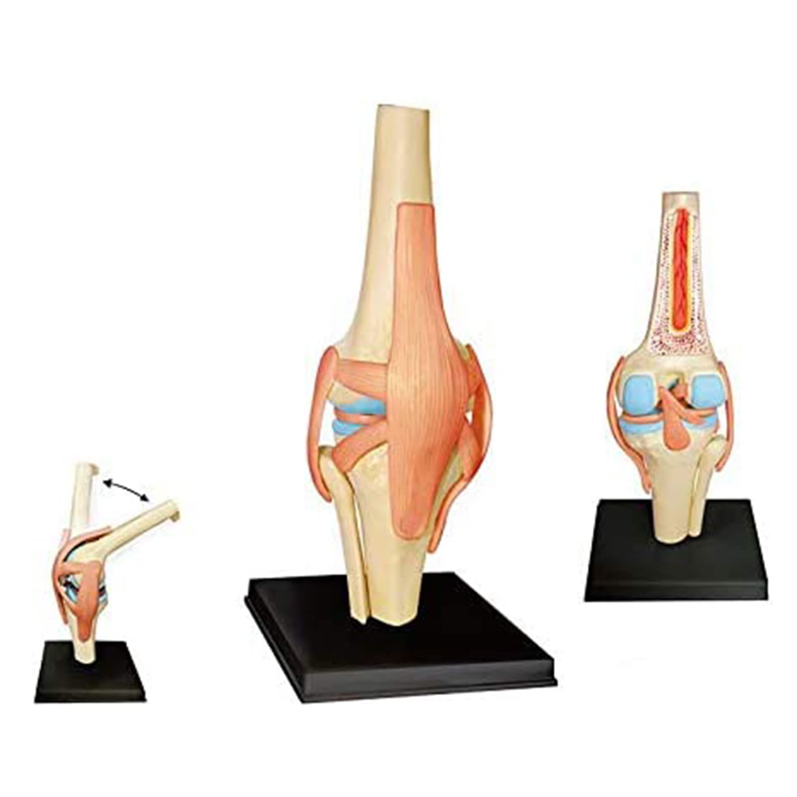 Kniegelenk anatomisches Modell - 19 abnehmbare Teile Medizinisches Lehrmodell - Medizinisches Unterricht anatomisches Kniemodell - für medizinische Bildungsausbildung
