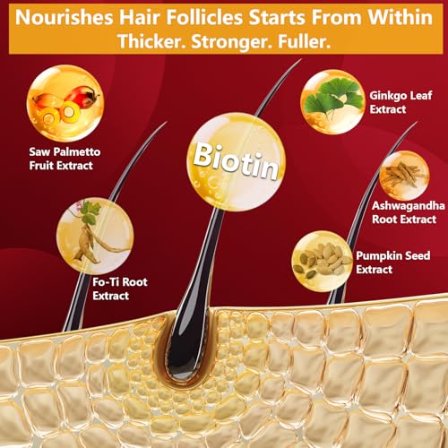 DHT Blocker for Men | Extra Strength Saw Palmetto & Biotin Hair Growth Supplement - Hair Growth Vitamins - Hair Regrowth - Natural Hair Loss Supplements for Men - Proprietary Herbal Blends,90 Capsules — view 4