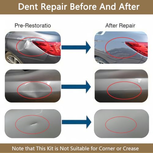 Image of Paintless Dent Repair Kit, Double Pole Bridge Dent Puller with 7 Bridge Tabs, Car Small Dent Removal Kit for Auto Body, Dent Puller for Fridge Door and Washer